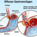 Dai l’addio al dolore con l’auricoloterapia